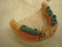 Implantology