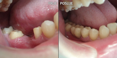 Fixed and mobile prosthetics