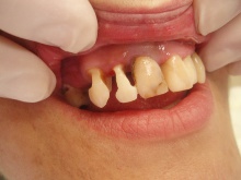 Restorative dentistry